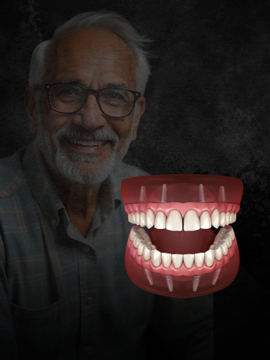 Full-mouth-fix-Denture