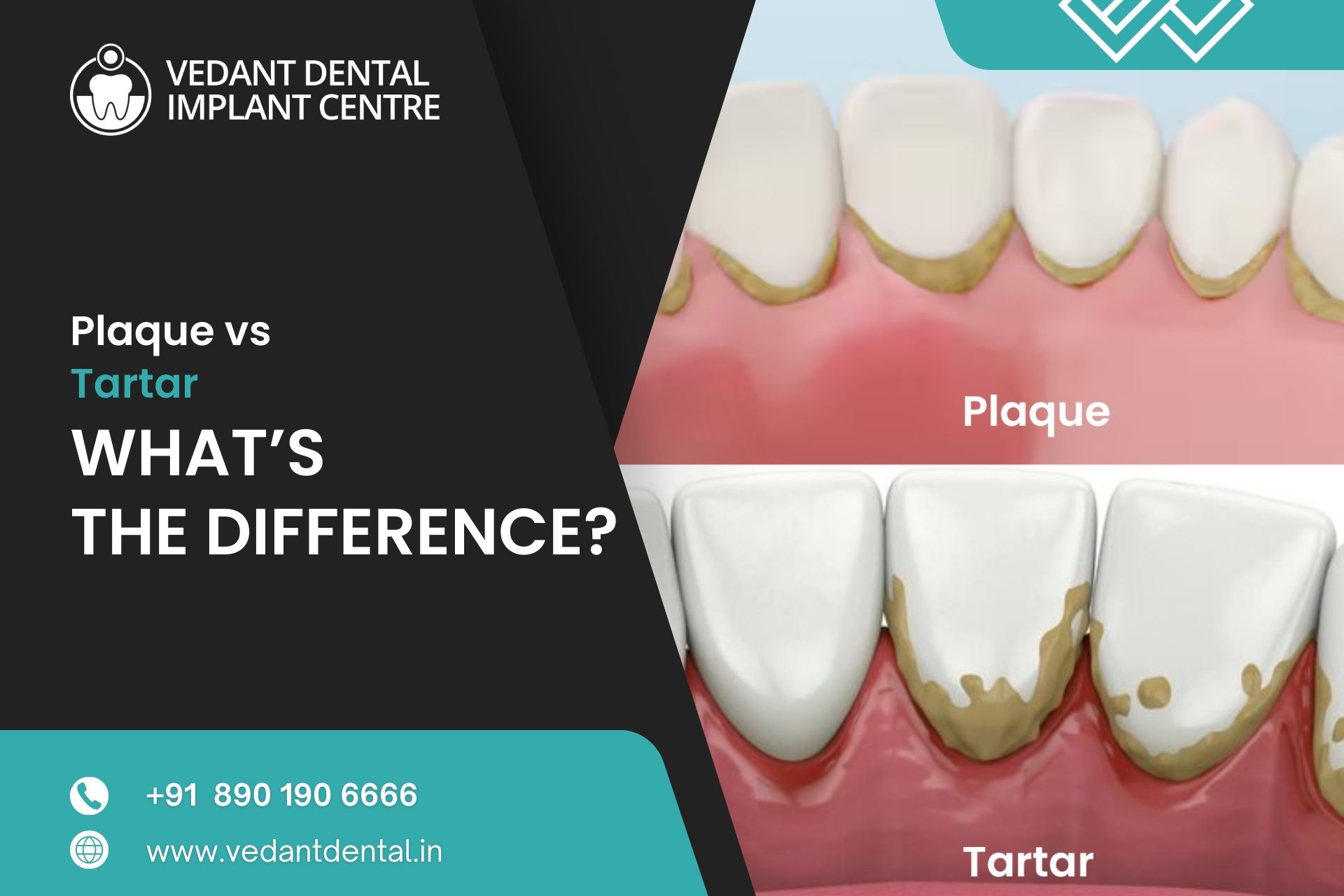 Family Dental Check-Ups in Faridabad: Keep Your Loved Ones Smiling